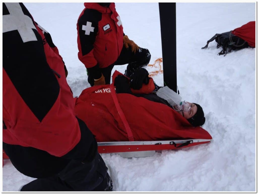 Skiing Accident Quad Tendon Ruptures Stevens Pass Ski Patrol 4